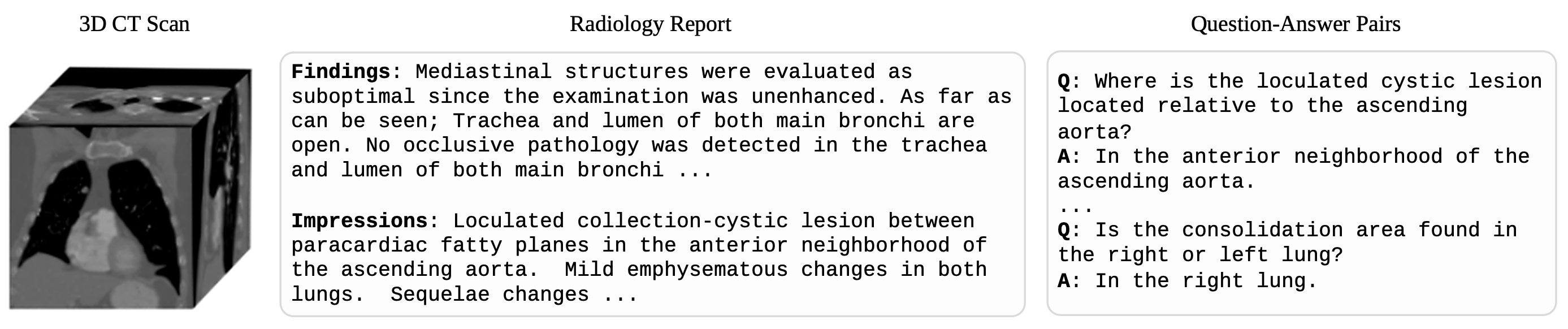 Example CT scan with radiology report and QA pairs